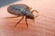 Bed Bug Exterminator Bed Bug Exterminators Bed Bug Exterminator Jacksonville fl Bed Bug Extermination companies Jacksonville fl Bed Bug Extermination company Jacksonville fl Bed Bug Extermination Jacksonville fl Bed Bug Extermination service Jacksonville fl Bed Bug Extermination services Jacksonville fl bed bug exterminator cost jacksonville fl